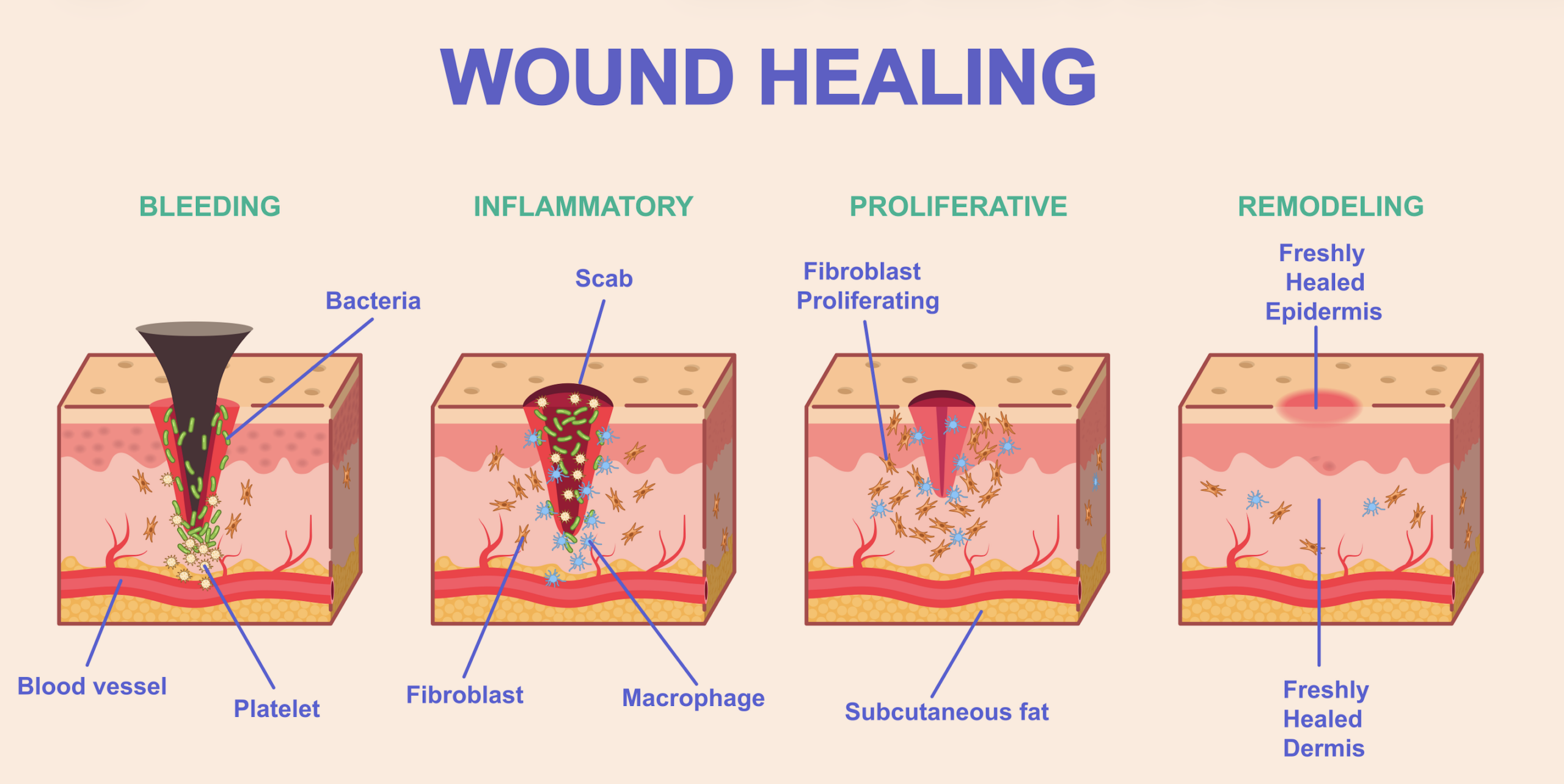 Τα 4 στάδια της επούλωσης των πληγών 